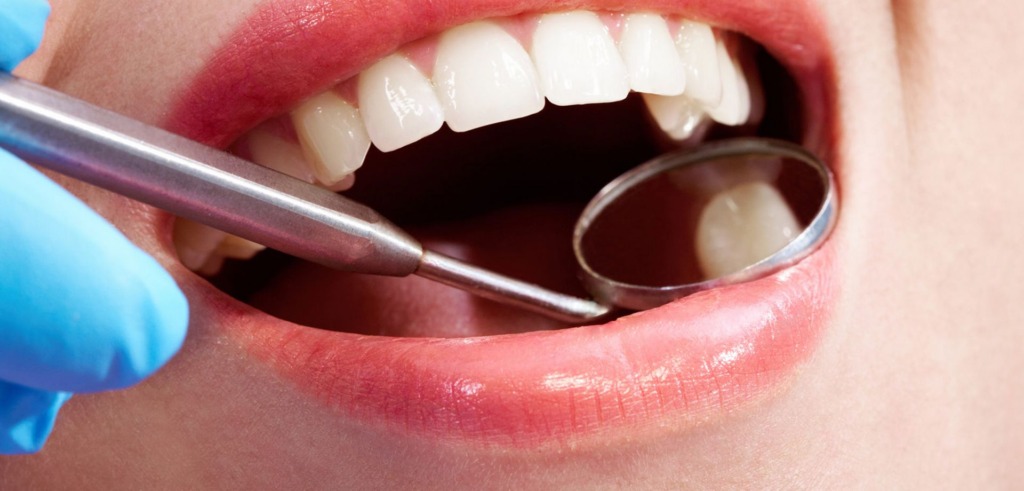 Dental care - White filling