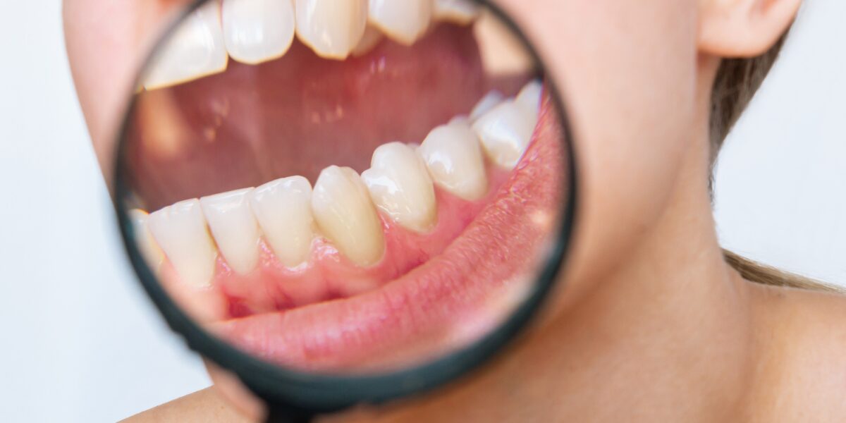 dental cleanings in Arlington, VA