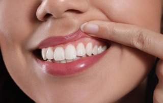 dentist in Arlington, VA