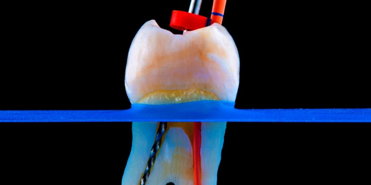Root canals