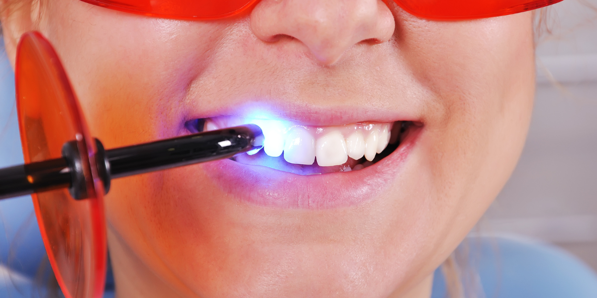 Tooth Filling